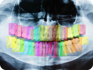 teeth classification image